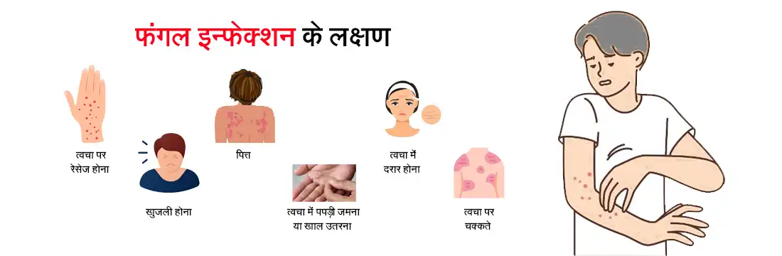 symptoms of fungal infection in hindi